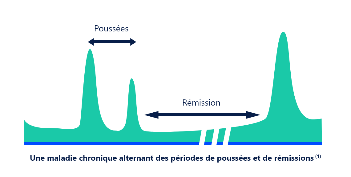 Une maladie chronique alternant des périodes de poussées et de rémissions